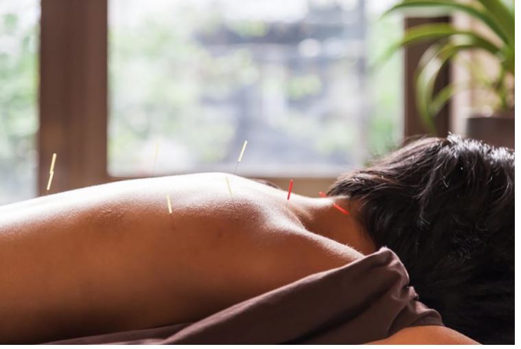 Reasons to try Acupucture for Weight Loss